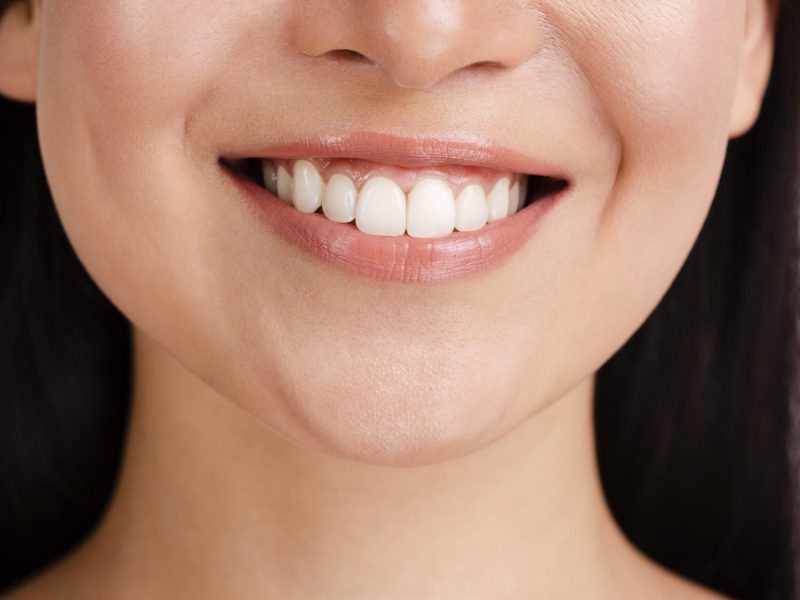 woman-s-smile-with-clear-skin